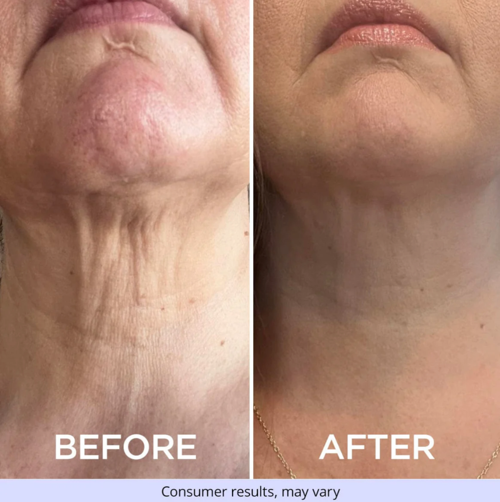 Tighten&Lift Neck Cream