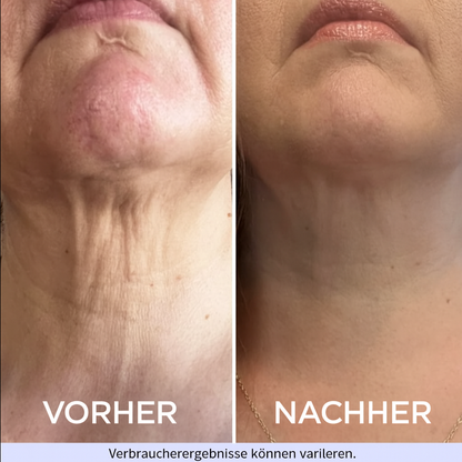 AYLAVERDE Straffende & Liftende Halscreme